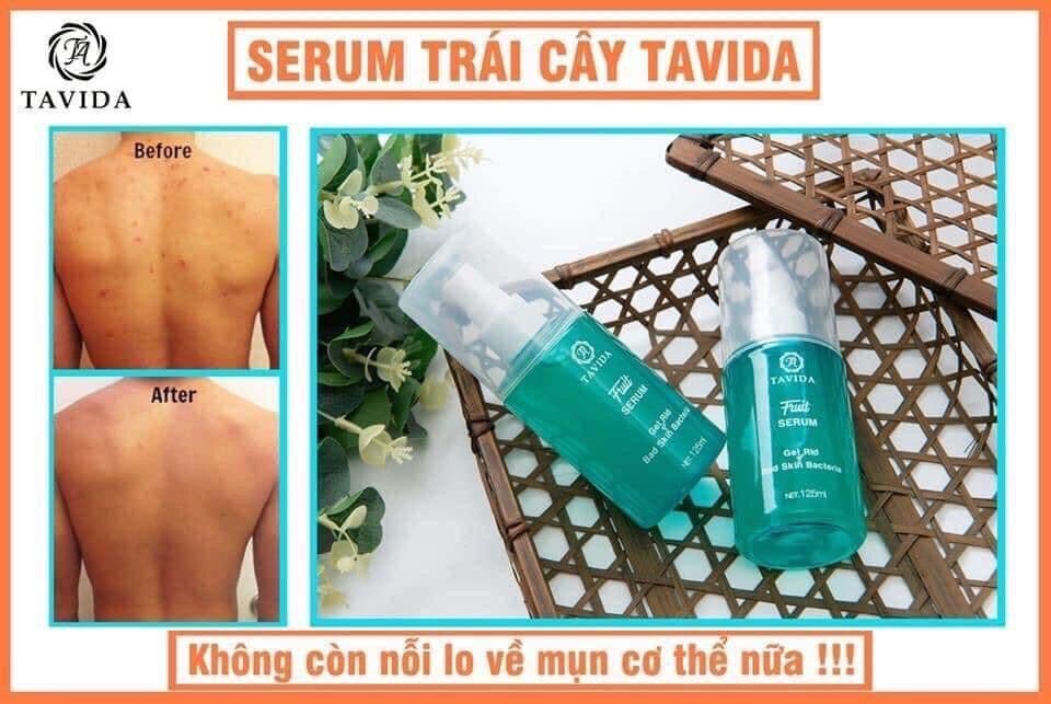 COMBO 2 chai SERUM TRÁI CÂY LÊN MEN TAVIDA * xịt mụn lưng men vi sinh tavida* DỨT ĐIỂM CÁC VẤN ĐỀ VỀ DA NHƯ VIÊM NANG LÔNG MỤN LƯNG NẤM NGỨA