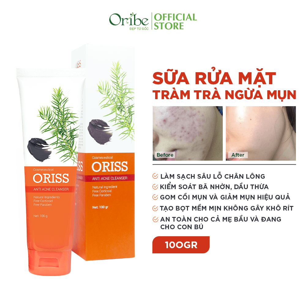 Sữa Rửa Mặt Tạo Bọt Ngừa Mụn Oriss 100g - Chuyên Dành Cho Da Mụn