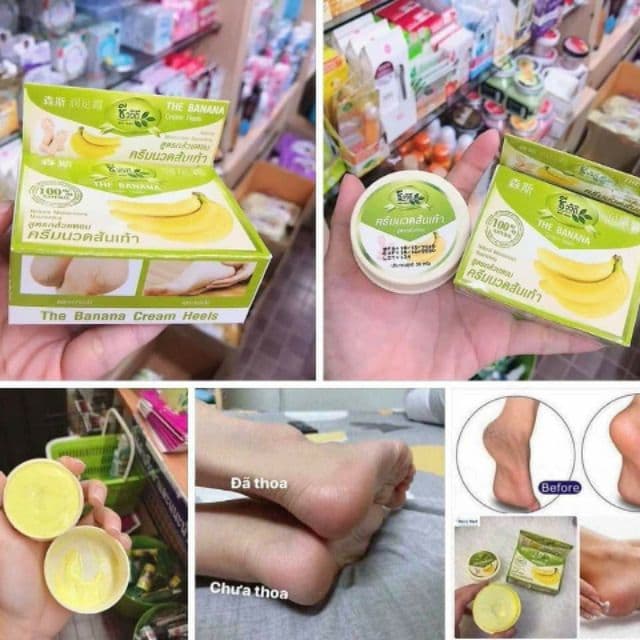 [HCM]Kem Dưỡng Nứt Gót Chân Chuối Thái Lan