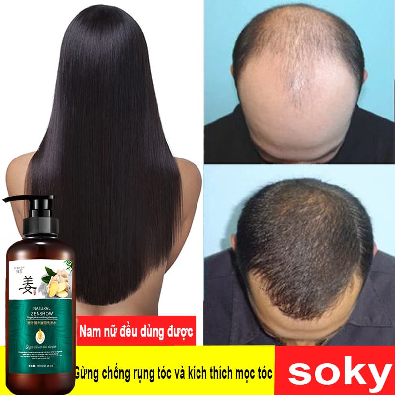 [Sạch Gàu] Dầu gội gừng đánh bay gàu  nấm da đầu hiệu quảchống rụng tóc ngăn ngừa gàu nấm thay thế dầu gội khô dầu gội gừng và dầu dưỡng tóc khác