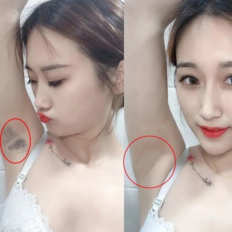 Kem Tẩy Lông Perfect Clean 150ml Triệt Lông Nách Triêt Lông Vùng Kín Lông Tay Chân Cơ thể An Toàn Tại Nhà - Serum Ức Chế Mọc Lông
