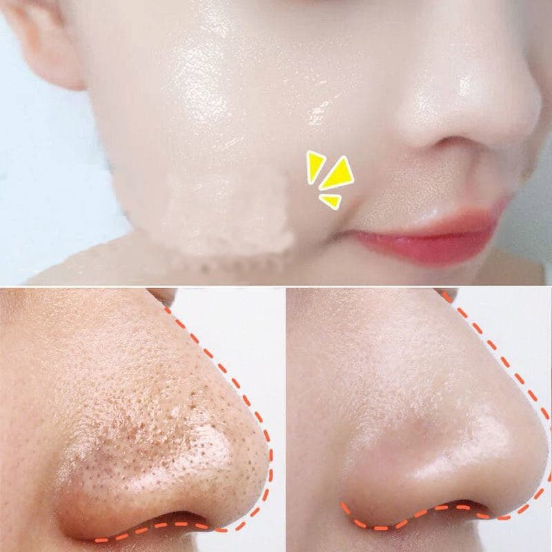 Kem dưỡng trắng da mặt thu nhỏ lỗ chân lông làm da trắng mịn cải thiện tính đàn hồi cho da Whitening Face Cream da khô chỗ nào bôi chỗ đó