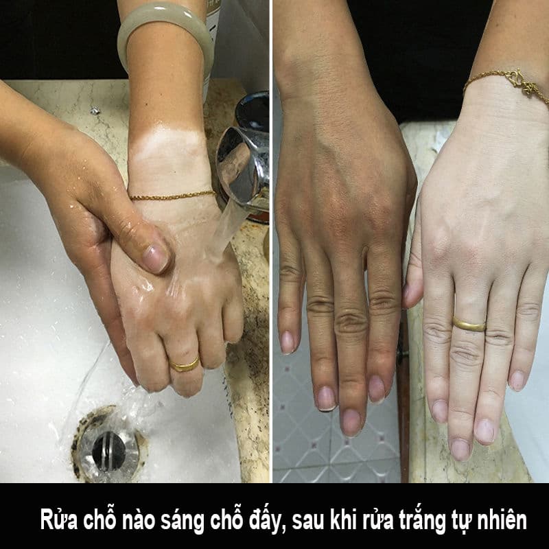 100% Kem Trắng Da MiYaShi bùn biển sâu chăm sóc da mặt lâu dài dưỡng ẩm làm mới kem dưỡng ẩm toàn thân bùn biển sâu làm trắng dưỡng ẩm 150g