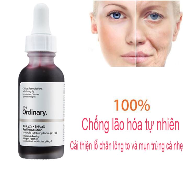 Tinh chất dưỡng trắng da tinh chất Serum The Ordinary AHA 30% + BHA 2% Peeling Solution công thức tẩy tế bào chết trên bề mặt 10 Phút 30ml Serum Dưỡng Da Mờ Sẹo Trị Mụn Làm Trắng Da Chăm Sóc Da