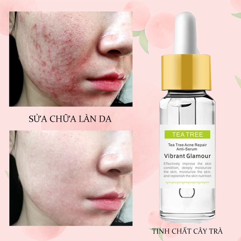 [HCM][Peachy Sis Shop] Serum tinh chất trà xanh chăm sóc bảo vệ kiểm soát chất nhờnthu nhỏ lỗ chân lông cho da mặt 15g VIBRANT GLAMOUR