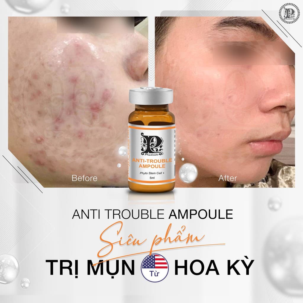 [HCM]Tinh Chất Giảm Mụn thâm Anti Trouble Ampoule Nuwhite Mibiti Prudente Professional Từ USA