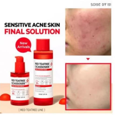 Nước Hoa Hồng Chiết Xuất Tràm Trà Đỏ Some By Mi Red Tea Tree Cicassoside Final Solution Toner 150ml