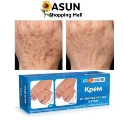 Kem Dưỡng Giúp Mờ Và Hồi Phục Các Đóm Đồi Mồi Nga Kpem