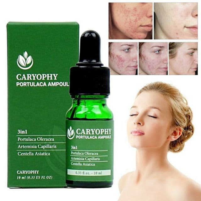 Serum rau má giảm mụn mờ thâm Caryophy Portulaca Ampoule - 10 ml