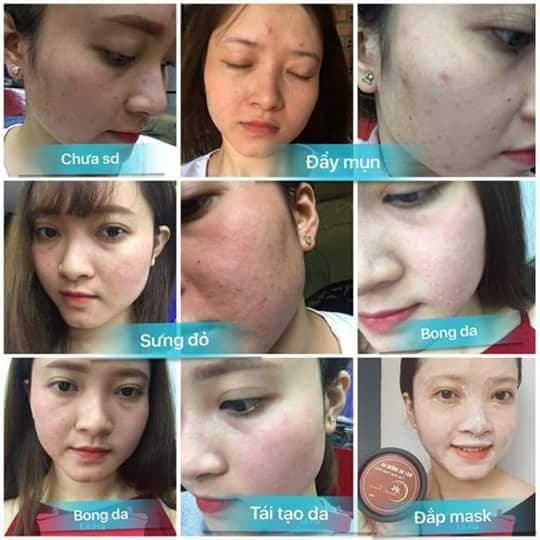 [HCM]Serum tái tạo da cấp tốc thanh trang  Thảo Dược Thanh Trang hàng chính hãng