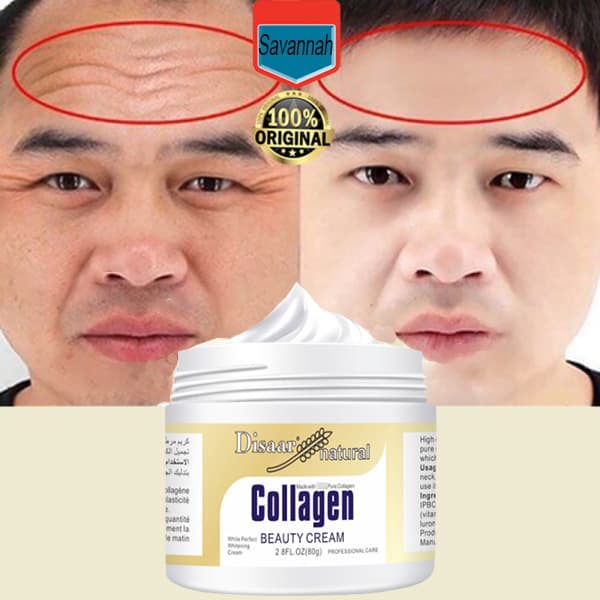 Kem dưỡng ẩm dưỡng trắng xoá tàn nhang làm sáng da kem dưỡng Collagen 80g làm mờ tàn nhang phục hồi da bị tổn thương kem dưỡng trắng làm sáng da ngăn ngừa lão hóa cho da mặt kem ngăn ngừa nếp nhăn vết châm chim. Kem dưỡng ẩm kem dưỡng ẩm chăm só