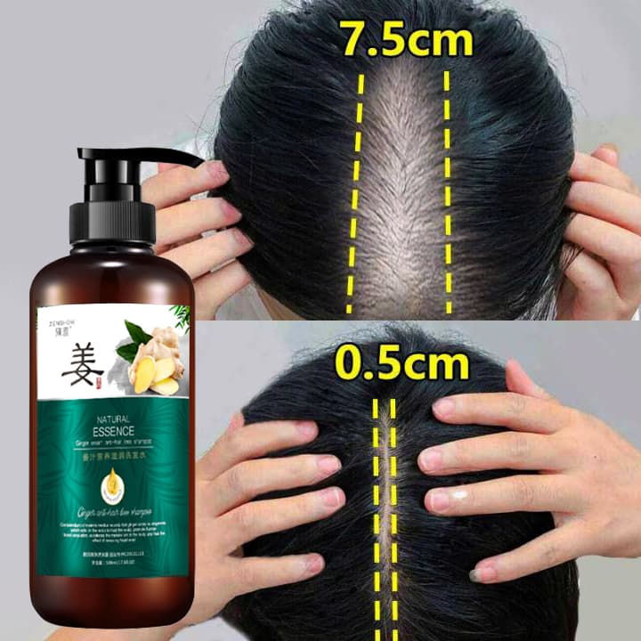 Combo Dầu Gội Xả gừng Dầu gội xả thiên nhiên gừng Cặp Dầu Gội Ngăn Ngừa Rụng Tóc Chống tóc gãy rụng Phục hồi hư tổn sạch gàu giúp tóc chắc khỏe và bóng mượt.