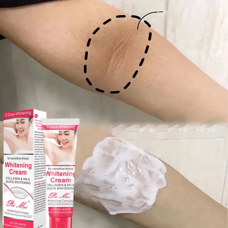 Kem Sát Nách Trắng Da Chân Đầu Gối Tư Nhân Phần Làm Trắng Công Thức Dưỡng Ẩm Thân Mật Chăm Sóc Da Kem dưỡng trắng