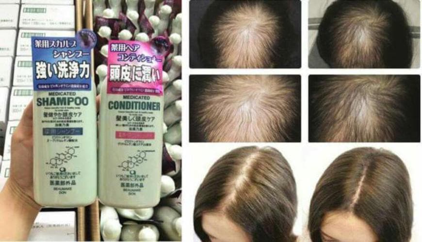 Dầu gội Kaminomoto chống rụng và kích thích mọc tóc 300ml