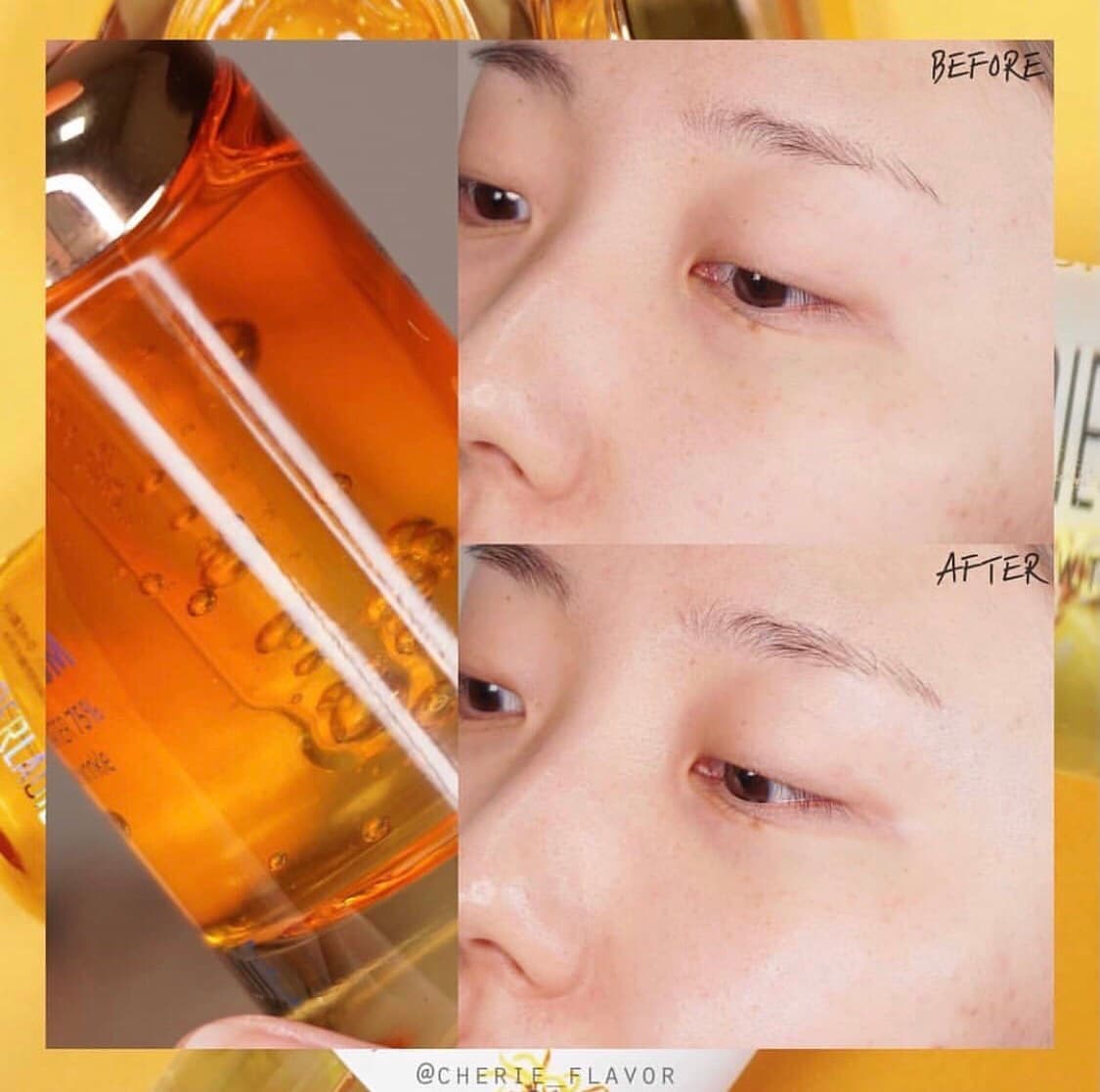 [HCM]Tinh chất giảm mụn Derladie Witch Hazel Perfect Vitamin Serum