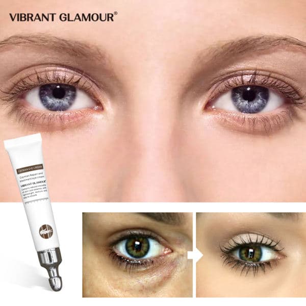 Vibrant Glamour Kem Mắt Cá Sấu Dưỡng Da Phục Hồi Da Làm Trắng Mờ Sẹo Quanh Mắt Eye Cream Whitening Scar Treatment