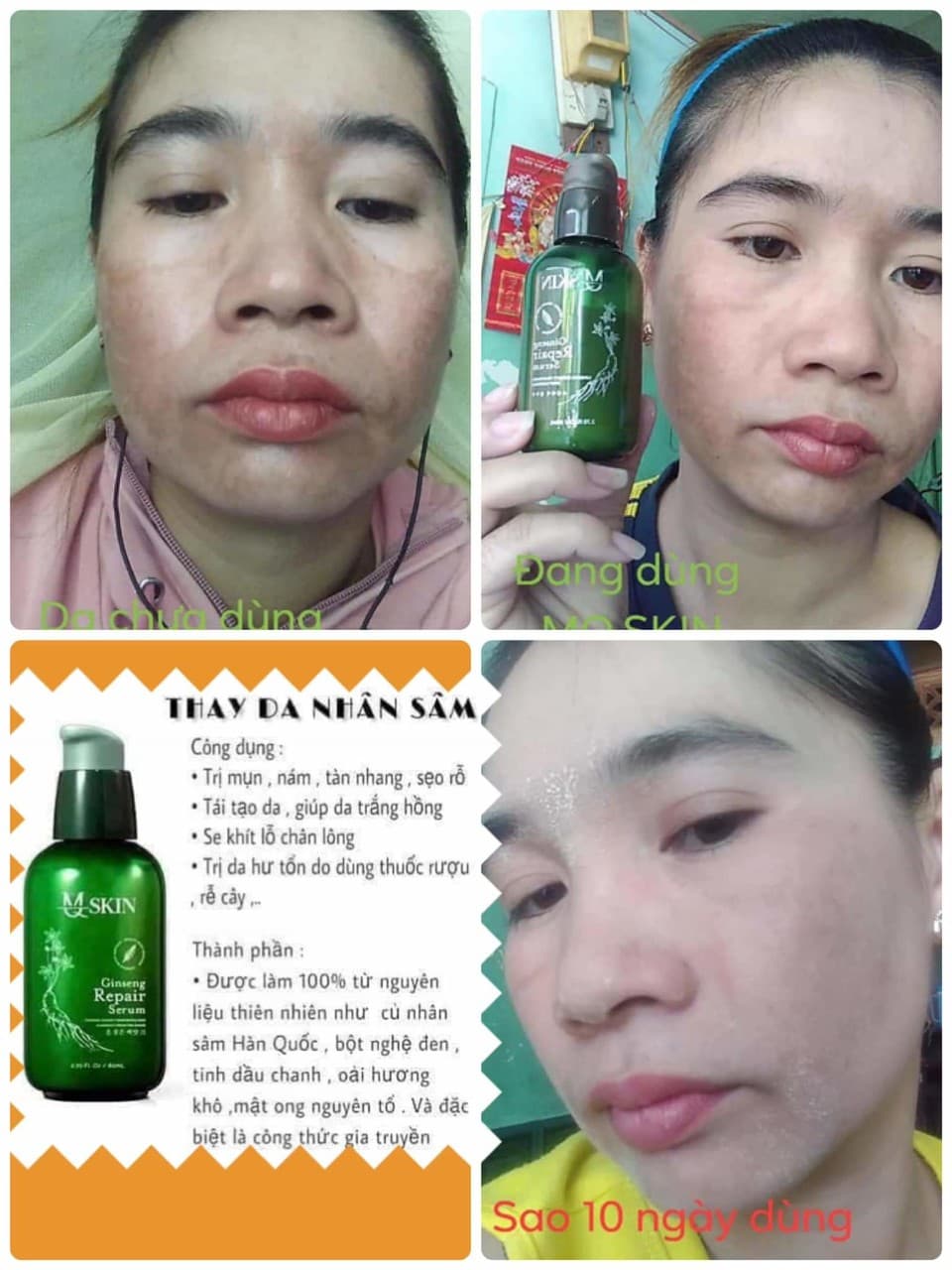 Serum Thay Da Nhân Sâm MQ Skin Chính Hãng 100% Tái Tạo Làn Da Mới Trắng Mịn Sạch Mụn Nám