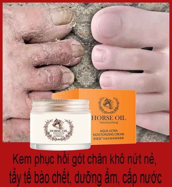 Kem dưỡng trắng da mặt thu nhỏ lỗ chân lông nẻ tay chân gót chân khô bong tróc kem dưỡng trắng da chống lão hóa da mỡ ngựa 50ml