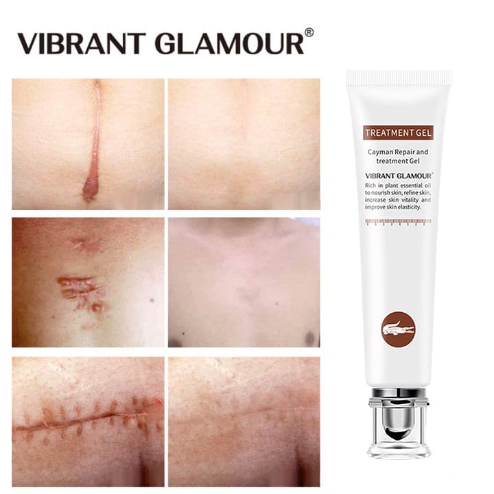 VIBRANT GLAMOUR Serum phục hồi sẹo dành cho da mặt phục hồi da phục hồi cải thiện vết thâm sẹo lồi sẹo lõm thu nhỏ lỗ chân lông làm sáng mịn da chăm sóc da nhạy cảm khối lượng 20g